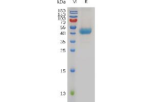 Human C Protein, hFc Tag on SDS-PAGE under reducing condition. (CXCR1 Protein (AA 1-39) (Fc Tag))