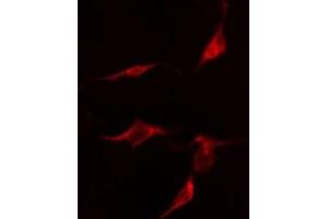 ABIN6275848 staining  HepG2 cells by IF/ICC. (MASTL 抗体  (C-Term))