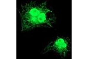 Anti-GDAP1L1 mouse monoclonal antibody (ABIN2454765) immunofluorescent staining of COS7 cells transiently transfected by pCMV6-ENTRY GDAP1L1 (RC200976). (GDAP1L1 抗体)