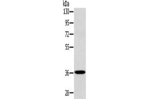 Western Blotting (WB) image for anti-PDZ and LIM Domain 1 (PDLIM1) antibody (ABIN2423957) (PDLIM1 抗体)