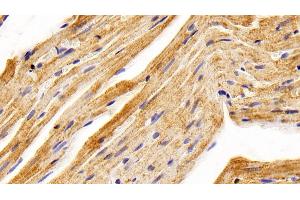 Detection of BMP2 in Rat Cardiac Muscle Tissue using Polyclonal Antibody to Bone Morphogenetic Protein 2 (BMP2) (BMP2 抗体  (AA 49-243))