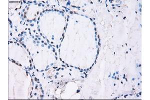 Immunohistochemical staining of paraffin-embedded Kidney tissue using anti-ID3mouse monoclonal antibody. (ID3 抗体)