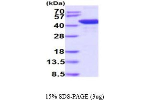 HDAC8 Protein (AA 1-377) (His tag)