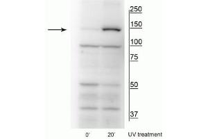 Western blot of HeLa cell lysates that had been treated with UV (~254 nm) for 0’ or 20’ showing specific immunolabeling of the ~150 kDa FANCI protein phosphorylated at Ser559. (FANCI 抗体  (pSer556))