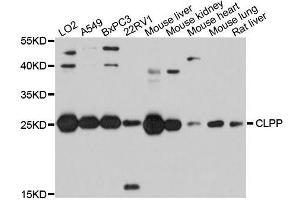 Western blot analysis of extracts of various cell lines, using CLPP antibody (ABIN5995818) at 1/1000 dilution. (CLPP 抗体)
