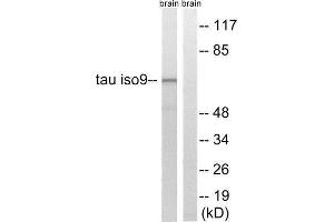 Western Blotting (WB) image for anti-tau Protein (Thr217), (Thr534) antibody (ABIN1848202) (tau 抗体  (Thr217, Thr534))