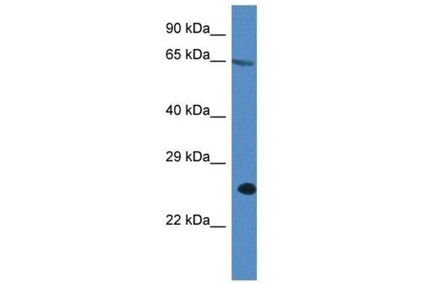 ITPRIP 抗体  (C-Term)