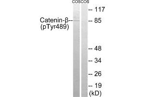 Western blot analysis of extracts from COS cells, treated with UV (15mins), using Catenin- beta (Phospho-Tyr489) antibody. (beta Catenin 抗体  (pTyr489))