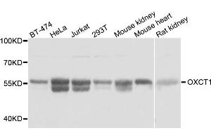 Western blot analysis of extracts of various cell lines, using OXCT1 antibody (ABIN5974499) at 1:3000 dilution. (OXCT1 抗体)