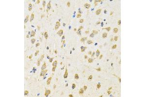 Immunohistochemistry of paraffin-embedded mouse brain using PTPRE antibody (ABIN2564811) at dilution of 1:100 (40x lens). (PTPRE 抗体)