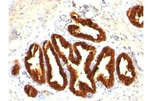 Immunohistochemistry (Formalin-fixed Paraffin-embedded Sections) (IHC (fp)) image for anti-Keratin 18 (KRT18) antibody (ABIN3026955)