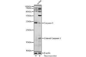 Western blot analysis of extracts of Jurkat cells, using Caspase-3 antibody (ABIN6131582, ABIN6137962, ABIN6137964 and ABIN6215049) at 1:1000 dilution. (Caspase 3 抗体  (AA 55-160))