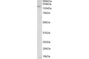 AP21281PU-N NUP107 antibody staining of Nuclear lysate of of NIH3T3 at 2 µg/ml (35µg protein in RIPA buffer). (NUP107 抗体  (Internal Region))