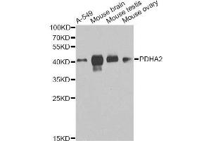 Western blot analysis of extracts of various cell lines, using PDHA2 antibody. (PDHA2 抗体  (AA 119-388))