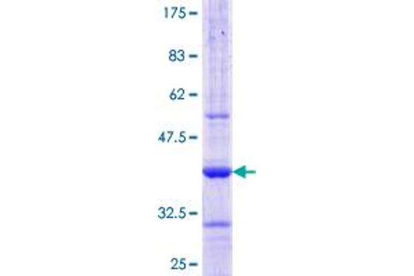 AAMP Protein (AA 111-210) (GST tag)