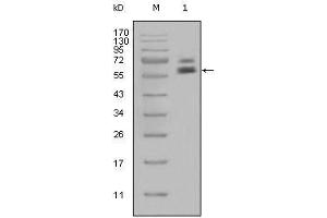 Western Blot showing CK5 antibody used against Hela cell lysate (1). (Cytokeratin 5 抗体)