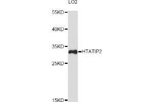 Western blot analysis of extracts of LO2 cells, using HTATIP2 antibody (ABIN6290469) at 1:3000 dilution. (HIV-1 Tat Interactive Protein 2, 30kDa (HTATIP2) 抗体)