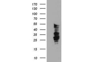 HEK293T cells were transfected with the pCMV6-ENTRY control (Left lane) or pCMV6-ENTRY SERPINB2 (Right lane) cDNA for 48 hrs and lysed. (SERPINB2 抗体)