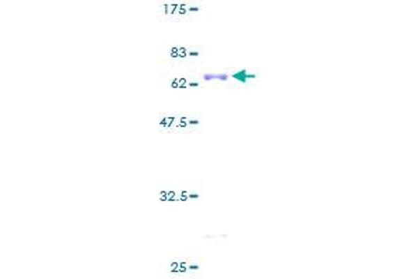 PECI/ECI2 Protein (AA 1-364) (GST tag)