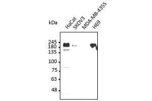 Anti-ERBBI Ab at dilution 1:2,500, 50 µg of total protein per Iane, rabbit polyclonal to goat lgG(HRP) at 1/10,000 dilution, (EGFR 抗体  (C-Term))