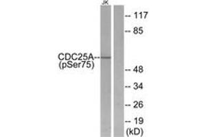 Western blot analysis of extracts from Jurkat cells treated with UV, using CDC25A (Phospho-Ser75) Antibody. (CDC25A 抗体  (pSer76))
