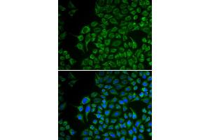 Immunofluorescence analysis of U2OS cells using TYR antibody. (TYR 抗体)