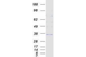 Validation with Western Blot (HSD17B6 Protein (Myc-DYKDDDDK Tag))