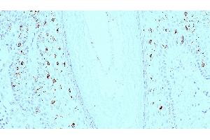 Human skin: immunohistochemical staining for langerin. (CD207 抗体)