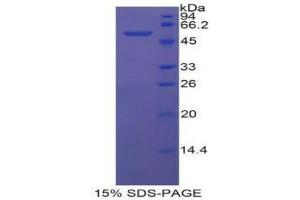 SDS-PAGE analysis of Mouse MCP Protein. (CD46 Protein (CD46))