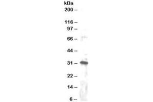Western blot testing of Jurkat lysate with DKK4 antibody at 1ug/ml. (DKK4 抗体)