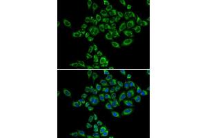 Immunofluorescence analysis of HeLa cells using SRPK1 antibody. (SRPK1 抗体)