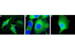 Expression of Mitochondrial uncoupling protein 2 (UCP2) in mouse C2C12 cells. (UCP2 抗体  (Intracellular))