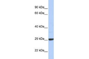 WB Suggested Anti-C10orf56 Antibody Titration: 0. (ZCCHC24 抗体  (Middle Region))
