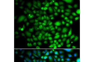 Immunofluorescence analysis of A549 cells using PTK6 Polyclonal Antibody (PTK6 抗体)