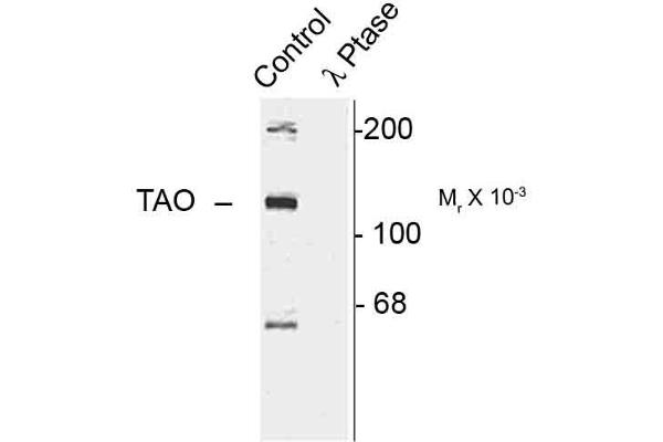 TAO Kinase 2 抗体  (pSer181)