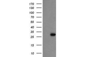 Image no. 1 for anti-Proline Synthetase Co-Transcribed (PROSC) antibody (ABIN1500441) (PROSC 抗体)