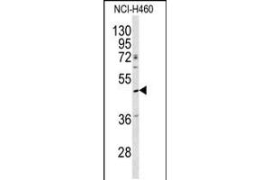 Western blot analysis of SERPINA4 antibody in NCI-H460 cell line lysates (35ug/lane) (SERPINA4 抗体  (C-Term))