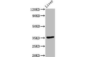 Western Blot Positive WB detected in: Rat liver tissue All lanes: EPCAM antibody at 9. (EpCAM 抗体  (AA 24-265))