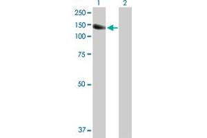 Western Blot analysis of PTK2B expression in transfected 293T cell line by PTK2B MaxPab polyclonal antibody. (PTK2B 抗体  (AA 1-1009))