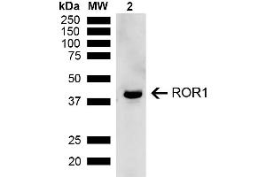 Western blot analysis of Rat Kidney showing detection of ~43 kDa ROR1 protein using Rabbit Anti-ROR1 Polyclonal Antibody (ABIN5667778). (ROR1 抗体  (AA 200-300) (APC))