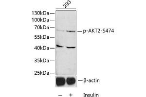 Western blot analysis of extracts of 293 cells, using Phospho--S474 antibody (ABIN3023507, ABIN3023508, ABIN3023509 and ABIN6225357) 1:1000 dilution. (AKT2 抗体  (pSer474))