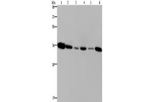 Western Blotting (WB) image for anti-Emerin (EMD) antibody (ABIN2423376) (Emerin 抗体)