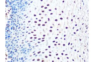 Immunohistochemistry of paraffin-embedded human esophageal using THOC4/THOC4/ALYREFREF Rabbit mAb (ABIN1679512, ABIN3018793, ABIN3018794 and ABIN7101662) at dilution of 1:100 (40x lens). (THO Complex 4 抗体)