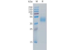 Cynomolgus B7-H6 Protein, His Tag on SDS-PAGE under reducing condition. (B7-H6 Protein (AA 25-259) (His tag))