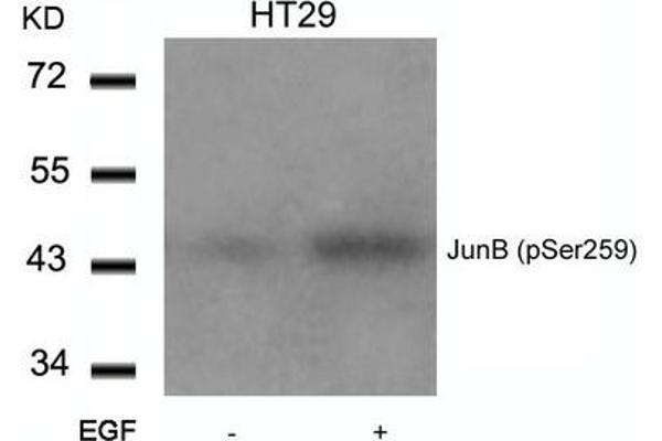 JunB 抗体  (pSer259)