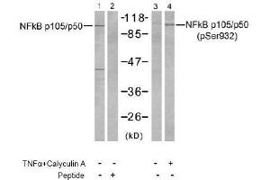 Image no. 2 for anti-Nuclear Factor of kappa Light Polypeptide Gene Enhancer in B-Cells 1 (NFKB1) (Ser932) antibody (ABIN197494) (NFKB1 抗体  (Ser932))