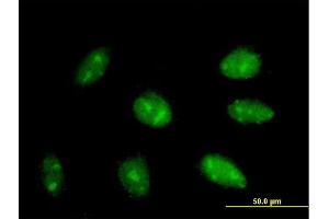 Immunofluorescence of purified MaxPab antibody to EXOSC3 on HepG2 cell. (EXOSC3 抗体  (AA 1-275))