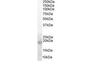 Western Blotting (WB) image for anti-Baculoviral IAP Repeat-Containing 5 (BIRC5) (C-Term) antibody (ABIN2476641) (Survivin 抗体  (C-Term))