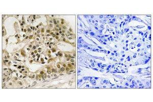 Immunohistochemistry (IHC) image for anti-V-Myb Myeloblastosis Viral Oncogene Homolog (Avian) (MYB) (pSer532) antibody (ABIN1847796) (MYB 抗体  (pSer532))