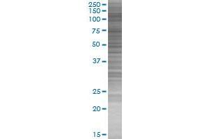 Western Blotting (WB) image for HIRA 293T Cell Transient Overexpression Lysate(Denatured) (ABIN1333818)